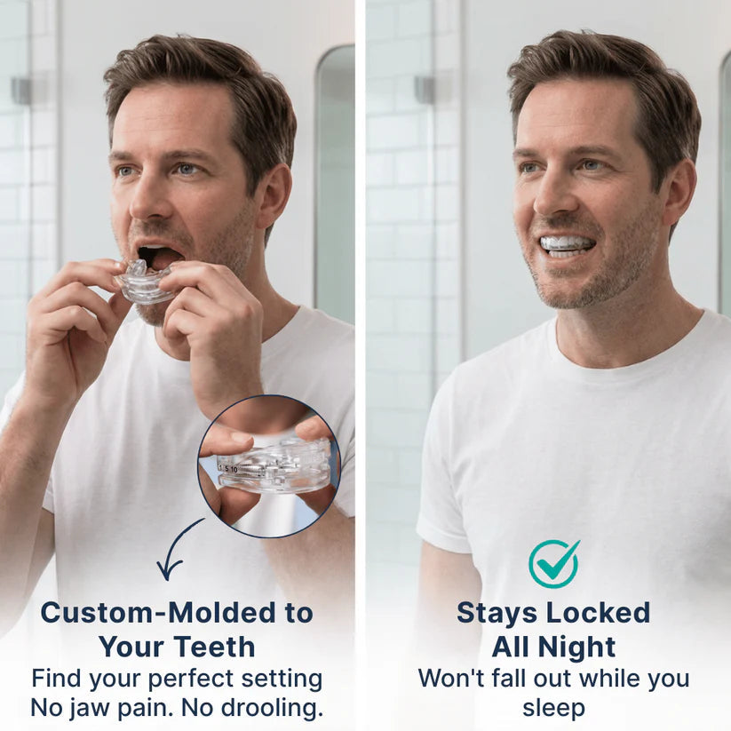 Anti-Snoring Mouthpiece