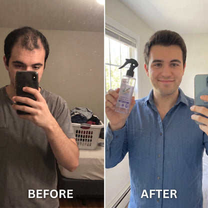 Rosemary + Rice Water Spray