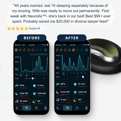 NeuroAir™ | Smart Anti-Snoring Neurostimulation Device